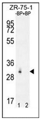 Western blot analysis of RAB40AL Antibdy (N-term) pre-incubated without (Lane 1) and with (Lane 2) blocking peptide in ZR-75-1 cell line lysate. RAB40AL Antibdy (N-term) (arrow) was detected using the purified RAB40AL Antibdy (N-term) (1/60/250 dilution).