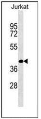 Western blot analysis of RBMS2 / SCR3 Antibody (N-term) in Jurkat cell line lysates (35ug/lane).This demonstrates the RBMS2 antibody detected the RBMS2 protein (arrow).