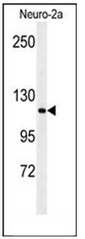 Western blot analysis of RERE Antibody (N-term) in Neuro-2a cell line lysates (35ug/lane). RERE (arrow) was detected using the purified Pab.