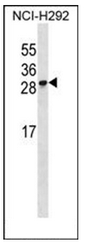 Western blot analysis of RFESD Antibody in NCI-H292 cell line lysates (35ug/lane). This demonstrates the RFESD antibody detected the RFESD protein (arrow).