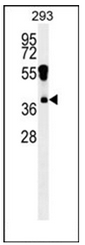 Western blot analysis of RHOXF2 Antibody (N-term) in 293 cell line lysates (35ug/lane).This demonstrates the RHOXF2 antibody detected the RHOXF2 protein (arrow).