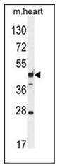 Western blot analysis of RILPL1 Antibody (C-term) in Mouse heart tissue lysates (35ug/lane). This demonstrates the RILPL1 antibody detected the RILPL1 protein (arrow).