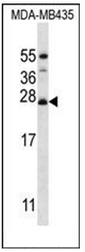 Western blot analysis of MRPL50 Antibody (C-term) in MDA-MB435 cell line lysates (35ug/lane). This demonstrates the RM50 antibody detected the RM50 protein (arrow).