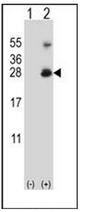 Western blot analysis of RNF11 (arrow) using RNF11 Antibody (Center). 293 cell lysates (2 ug/lane) either nontransfected (Lane 1) or transiently transfected (Lane 2) with the RNF11 gene.