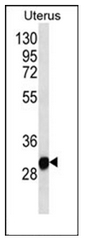 Western blot analysis of RNF148 Antibody (C-term) in Human normal Uterus cell line lysates (35ug/lane). This demonstrates the RNF148 antibody detected the RNF148 protein (arrow).