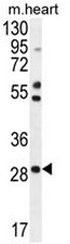 RNF183 Antibody (Center) western blot analysis in mouse heart tissue lysates (35ug/lane).This demonstrates the RNF183 antibody detected the RNF183 protein (arrow).