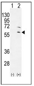 Western blot analysis of RPS6KL1 (arrow) using RPS6KL1 Antibody. 293 cell lysates (2 ug/lane) either nontransfected (Lane 1) or transiently transfected (Lane 2) with the RPS6KL1 gene.