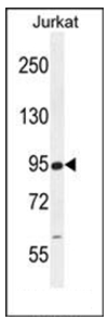 Western blot analysis in Jurkat cell line lysates (35 ug/lane) using RSBN1 Antibody (N-term). This demonstrates the RSBN1 antibody detected the RSBN1 protein (arrow).