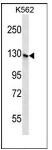 Western blot analysis in K562 cell line lysates (35 ug/lane) using S3TC1 Antibody (C-term). This demonstrates the S3TC1 antibody detected the S3TC1 protein (arrow). Western blot analysis in K562 cell line lysates (35 ug/lane) using S3TC1 Antibody (C-term). This demonstrates the S3TC1 antibody detected the S3TC1 protein (arrow).