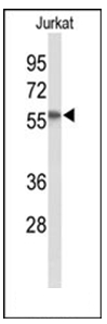Western blot analysis in Jurkat cell line lysates (35 ug/lane) using SACM1L Antibody (C-term). SACM1L (arrow) was detected using the purified Pab.