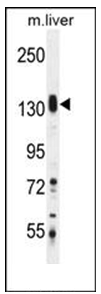 Western blot analysis of SASH1 Antibody (Center) in Mouse liver tissue lysates (35 ug/lane). This demonstrates the SASH1 antibody detected the SASH1 protein (arrow).