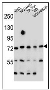 Western blot analysis of SEC14L5 Antibody (Center) in K562, NCI-H460, ZR-75-1, 293, MDA-MB231 cell line lysates (35ug/lane). This demonstrates the SEC14L5 antibody detected the SEC14L5 protein (arrow).