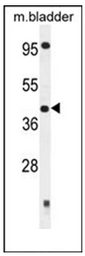 Western blot analysis of SLFNL1 Antibody (N-term) in Mouse bladder tissue lysates (35ug/lane). This demonstrates the SLFNL1 antibody detected the SLFNL1 protein (arrow).