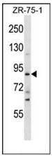 Western blot analysis of SLITRK4 Antibody (C-term) in ZR-75-1 cell line lysates (35ug/lane). This demonstrates the SLITRK4 antibody detected the SLITRK4 protein (arrow).