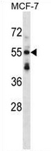 Western blot analysis in MCF-7 cell line lysates (35ug/lane) using Syntrophin-3 / SNTB2 antibody.This demonstrates the Syntrophin-3 antibody detected the Syntrophin-3 protein (arrow).