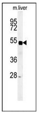 Western blot analysis of SP5 Antibody (C-term) in Mouse liver tissue lysates (35ug/lane).SP5 (arrow) was detected using the purified Pab.