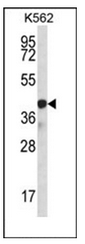 Western blot analysis of SP6 / KLF14 Antibody in K562 cell line lysates (35ug/lane). This demonstrates the SP6 antibody detected the SP6 protein (arrow).