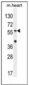 Western blot analysis of SP8 Antibody (C-term) in Mouse heart tissue lysates (35ug/lane).This demonstrates the SP8 antibody detected the SP8 protein (arrow).