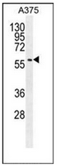 Western blot analysis of SPDYE3 Antibody in A375 cell line lysates (35ug/lane). This demonstrates the SPDYE3 antibody detected the SPDYE3 protein (arrow).