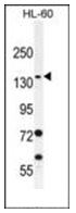 Western blot analysis of SPECC1 Antibody (Center) in HL-60 cell line lysates (35ug/lane). This demonstrates the SPECC1 antibody detected the SPECC1 protein (arrow).