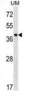 Western blot analysis in UM cell line lysates (35ug/lane) using SPOPL antibody. This demonstrates the SPOPL antibody detected the SPOPL protein (arrow).