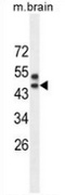 Western blot analysis in mouse brain tissue lysates (35ug/lane) using SPRED3 antibody. (N-term). This demonstrates the SPRED3 antibody detected the SPRED3 protein (arrow).