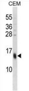 Western blot analysis in CEM cell line lysates (35ug/lane) using SPRR3 / Cornifin beta antibody. (C-term). This demonstrates the SPRR3 antibody detected the SPRR3 protein (arrow).