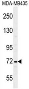 Western blot analysis in MDA-MB435 cell line lysates (35ug/lane) using SRBD1 antibody. (C-term). This demonstrates the SRBD1 antibody detected the SRBD1 protein (arrow). Western blot analysis in MDA-MB435 cell line lysates (35ug/lane) using SRBD1 antibody. (C-term). This demonstrates the SRBD1 antibody detected the SRBD1 protein (arrow).