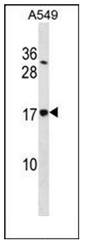 Western blot analysis of SSR4 / TRAPD Antibody in A549 cell line lysates (35ug/lane).This demonstrates the SSR4 antibody detected the SSR4 protein (arrow).
