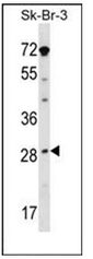 NHP2L1 antibody detects NHP2L1 protein by Western blot analysis. A. 30ug PC-12 whole cell lysate/extract. B. 30ug Rat2 whole cell lysate/extract. 15 % SDS-PAGE. NHP2L1 antibody (TA307906) dilution: 1:1000