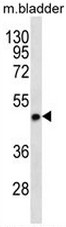 STX5 Antibody (Center) western blot analysis in mouse bladder tissue lysates (35ug/lane).This demonstrates the STX5 antibody detected the STX5 protein (arrow).