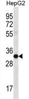 SULT1A3/SULT1A4 Antibody (N-term) western blot analysis in HepG2 cell line lysates (35ug/lane).This demonstrates the SULT1A3/SULT1A4 antibody detected the SULT1A3/SULT1A4 protein (arrow). SULT1A3/SULT1A4 Antibody (N-term) western blot analysis in HepG2 cell line lysates (35ug/lane).This demonstrates the SULT1A3/SULT1A4 antibody detected the SULT1A3/SULT1A4 protein (arrow).