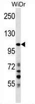 SUSD2 Antibody (C-term) western blot analysis in WiDr cell line lysates (35 ug/lane). This demonstrates the SUSD2 antibody detected the SUSD2 protein (arrow).