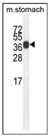 Western blot analysis using SYT8 Antibody (Center) in Mouse stomach tissue lysates (35ug/lane). This demonstrates the SYT8 antibody detected the SYT8 protein (arrow).