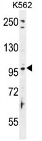 TAS1R2 Antibody (C-term) western blot analysis in K562 cell line lysates (35ug/lane).This demonstrates the TAS1R2 antibody detected the TAS1R2 protein (arrow).