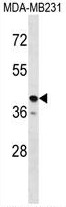 TAS2R31 Antibody (C-term) western blot analysis in MDA-MB231 cell line lysates (35ug/lane).This demonstrates the TAS2R31 antibody detected the TAS2R31 protein (arrow).