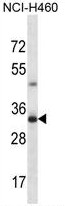 TBC1D21 Antibody (N-term) western blot analysis in NCI-H460 cell line lysates (35ug/lane).This demonstrates the TBC1D21 antibody detected the TBC1D21 protein (arrow).