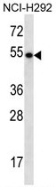 TBC1D3E Antibody (C-term) western blot analysis in NCI-H292 cell line lysates (35ug/lane).This demonstrates the TBC1D3E antibody detected the TBC1D3E protein (arrow).