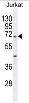 TBC1D3H Antibody (N-term) (Cat. #AP54172PU-N) western blot analysis in Jurkat cell line lysates (35g/lane).This demonstrates the TBC1D3H antibody detected the TBC1D3H protein (arrow).