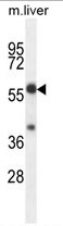 TBCCD1 Antibody (C-term) western blot analysis in mouse liver tissue lysates (35ug/lane).This demonstrates the TBCCD1 antibody detected the TBCCD1 protein (arrow).