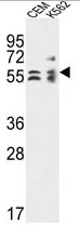 TBCE Antibody (Center) western blot analysis in CEM, K562 cell line lysates (35ug/lane).This demonstrates the TBCE antibody detected the TBCE protein (arrow).
