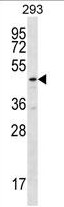 TBCEL Antibody (C-term) western blot analysis in 293 cell line lysates (35ug/lane).This demonstrates the TBCEL antibody detected the TBCEL protein (arrow).