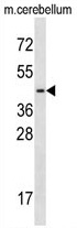 Sample (30ug of whole cell lysate). A: A431. 7.5% SDS PAGE. TA308011 diluted at 1:1000.