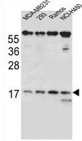 TCRB Antibody (Center) (AP54207PU-N) western blot analysis in MDA-MB231, 293, Ramos, NCI-H460 cell line lysates (35 g/lane). This demonstrates the TCRB antibody detected the TCRB protein (arrow).