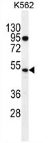 Sample (30ug of whole cell lysate). A:293T. B:HeLa. 10% SDS PAGE. TA308018 diluted at 1:500