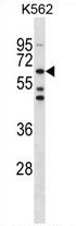 TESK1 Antibody (Center) western blot analysis in K562 cell line lysates (35 ug/lane). This demonstrates the TESK1 antibody detected the TESK1 protein (arrow).