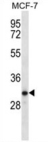 Sample (30ug of whole cell lysate). A: H1299. 7.5% SDS PAGE. TA308024 diluted at 1:1000.