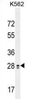 TEX13B Antibody (C-term) western blot analysis in K562 cell line lysates (35 ug/lane). This demonstrates the TEX13B antibody detected the TEX13B protein (arrow).