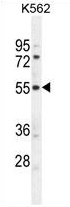 TEX9 Antibody (N-term) western blot analysis in K562 cell line lysates (35 ug/lane). This demonstrates the TEX9 antibody detected the TEX9 protein (arrow).