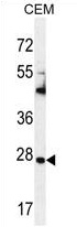 Sample (30ug of whole cell lysate). A: 293T. B: A431. C: H1299. 10% SDS PAGE. TA308045 diluted at 1:1000.